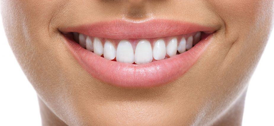 دندان سفید